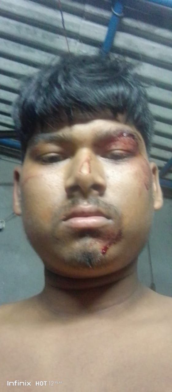 রায়দিঘিতে আক্রান্ত হিন্দুর পাশে দাঁড়াল হিন্দু মিলন সংঘ