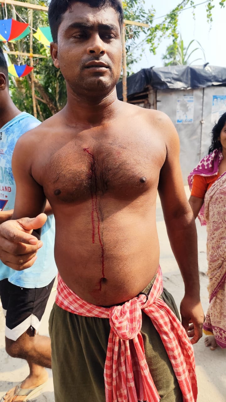 উস্তিতে কালীপূজায় জিহাদী আক্রমণে রক্ত ঝরল চিরঞ্জিত মণ্ডলের